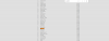 aaaaaaaaaaaaaaaaaaaaaaaaaaaaaaaaaaaaa.png